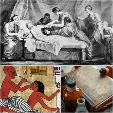 Unheard of Facts About Ancient Medical Practices